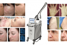 Joulex: la multiplataforma láser que soluciona afecciones dermatológicas, problemas estéticos e incluso íntimos!