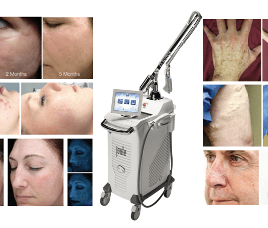 Joulex: la multiplataforma láser que soluciona afecciones dermatológicas, problemas estéticos e incluso íntimos!